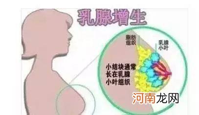 轻微乳腺增生有什么症状