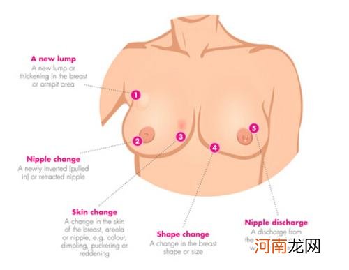 乳腺炎早期如何治疗