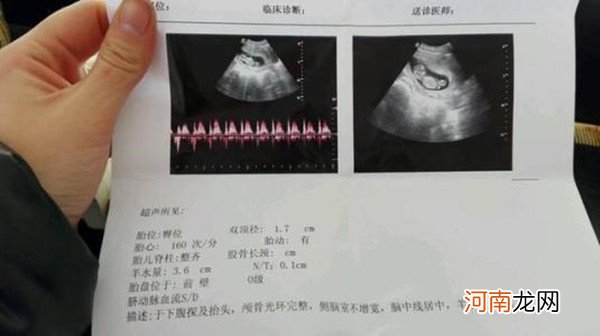 nt11周与12周有区别吗 做nt最佳时间是几周