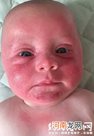 妈妈一个吻竟把孩子弄成脑瘫 亲吻宝宝的危害莫忽视