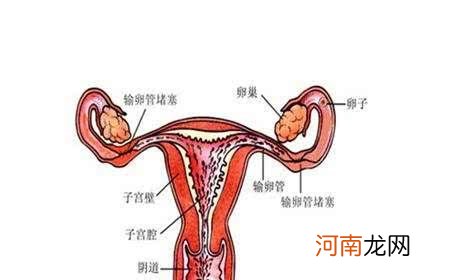 女性腺体堵塞的原因