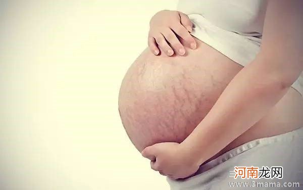 孕晚期肚子长妊娠纹怎么办