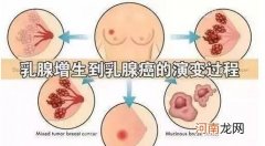 乳腺增生平时吃什么好