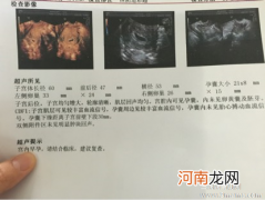 孕晚期胎心125正常吗