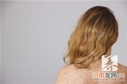 女性白斑病图片