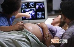 孕妇怀孕36周注意事项及36周胎儿彩超图