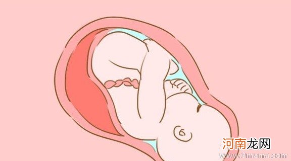 孕期会阴按摩帮你避免顺产侧切