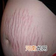 和妊娠纹说“拜拜”4个方法