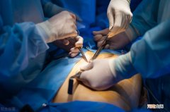 腹腔镜手术后如何保养 做完腹腔镜子宫肌瘤手术后注意事项