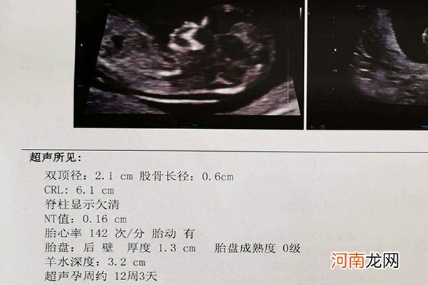 12周和13周检查nt数值一样吗 nt值能看男女吗