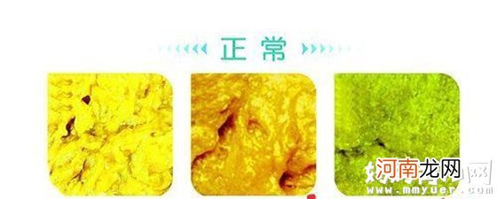 附图 史上最详细的婴儿大便颜色常识图解