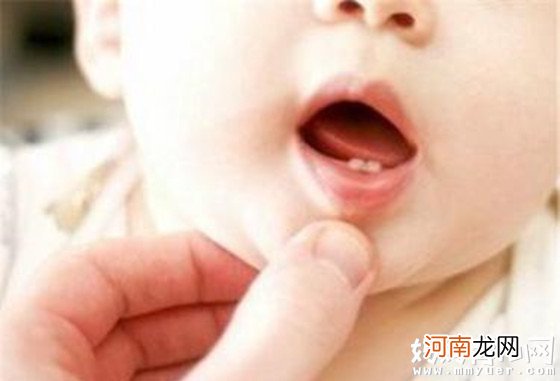 出牙时间有早有晚 宝宝几个月长牙算正常