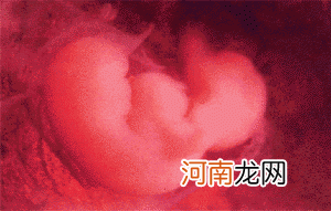 怀孕1个月胎儿发育状况及护理知识