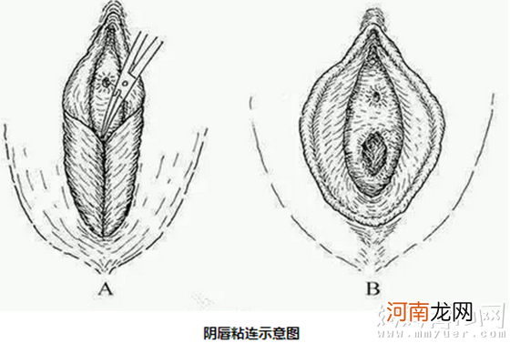 女宝宝私处这样护理洗了比不洗更糟糕