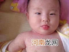 夏天宝宝长痱子该如何护理