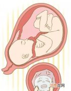 胎儿宫内缺氧的原因 胎儿在肚子里缺氧的表现