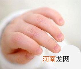 宝宝指甲不平有凹凸是什么原因？详解健身生活知识