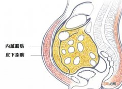 抽脂肪后的危害图片