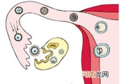 输卵管堵塞的症状自测 输卵管堵塞的症状