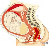 前期如何感觉自己怀孕了 如何判断自己有没有怀孕