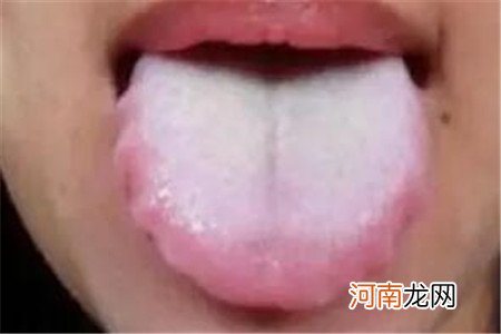 舌苔发白是什么原因呢，盘点五大导致的根源