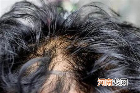 为什么每天洗头头发还是很油，或是这四个原因