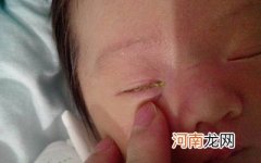 小宝宝眼屎多，妈妈该怎么护理