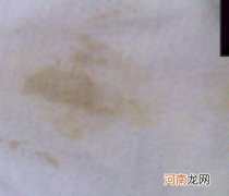 哺乳期内裤上有褐色分泌物