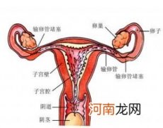 输卵管堵塞有哪些症状