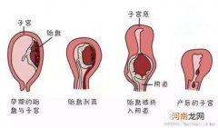 产后子宫恢复的注意事项有哪些