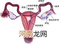 什么是输卵管性不孕