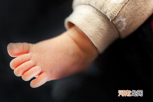 新生儿黄疸值对照表 黄疸生理or病理一目了然