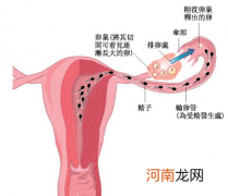 输卵管阻塞别忙做“试管婴”啊