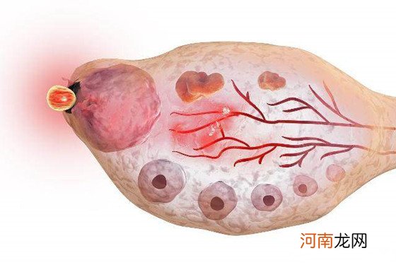 着床出血一般是第几天因人而异 不过多数都在这几天