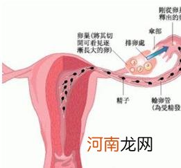 输卵管“道路”崎岖该如何打通