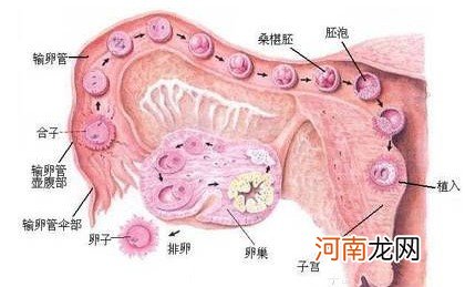 多囊卵巢与不孕症的关系