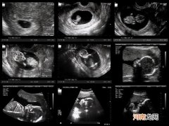 孕早期多天做一次b超检查 怀孕初期多久做b超能看见孕囊