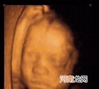 五个月胎儿彩超图 五个月胎宝宝长什么样