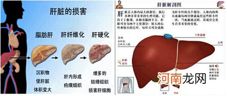 引起轻度脂肪肝的原因