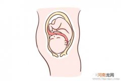 胎儿脐带绕颈的原因及危害
