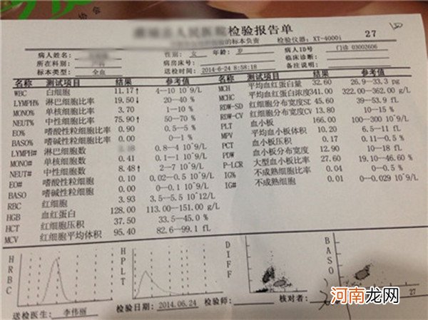 血常规哪个数据看男女 主要看单子上的4个数据