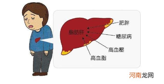 重度脂肪肝能逆转成正常吗