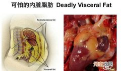 肝脏脂肪含量超过正常值