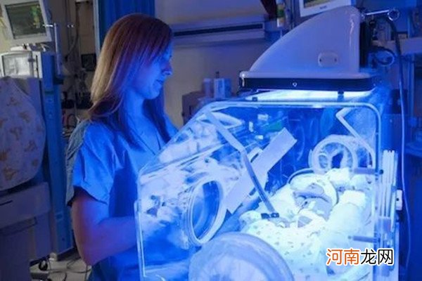 判断母乳性黄疸最直接的方法及注意事项