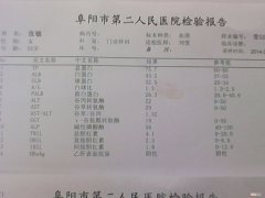 怎样检查有没有肝病