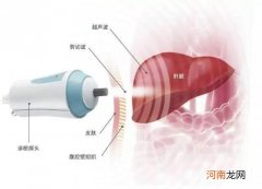 肝脏弹性硬度检查报告如何看