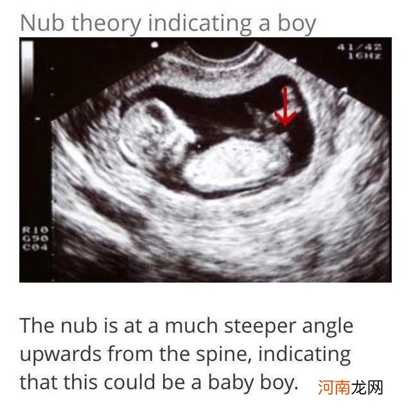 nt胎儿头颅形状看男女 亲证有效的B超自测男女方法