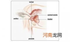 前列腺少量钙化灶