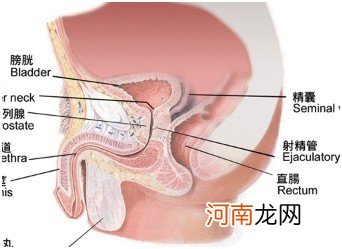 前列腺钙化灶严重性