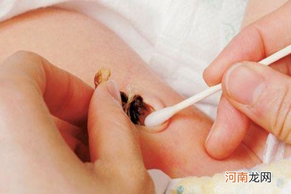 新生儿脐带20天未脱落 脐带未脱皮肤红肿怎么破